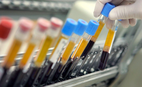 У европейских чиновников в крови обнаружили угрожающие жизни «вечные химикаты»